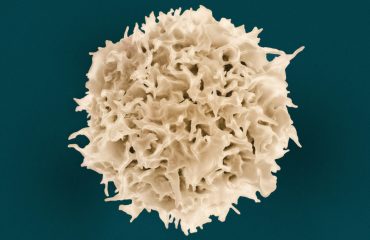 national-institute-of-allergy-and-infectious-diseases-5v0UyRolNwg-unsplash