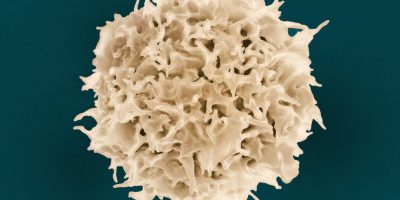 national-institute-of-allergy-and-infectious-diseases-5v0UyRolNwg-unsplash